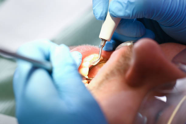 Best Emergency Denture Repair in Dale, IN