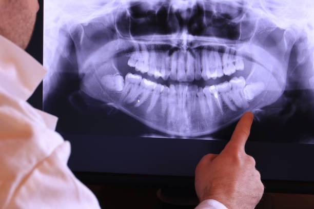 Best Emergency Root Canal Treatment in Dale, IN